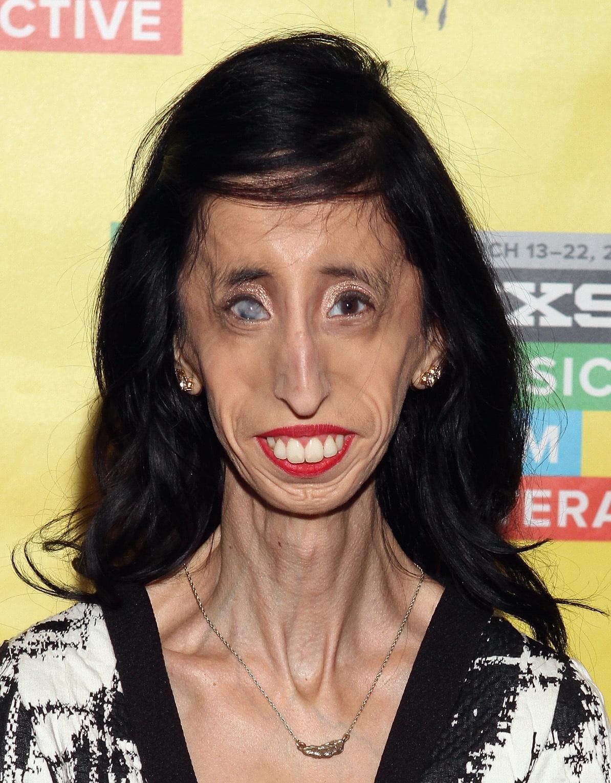 Lizzie Velasquez