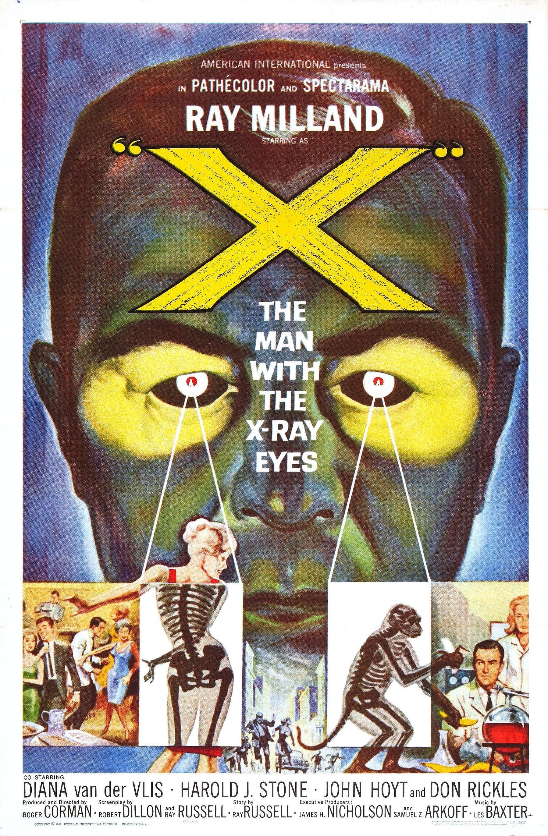 The Man with the X-Ray Eyes
