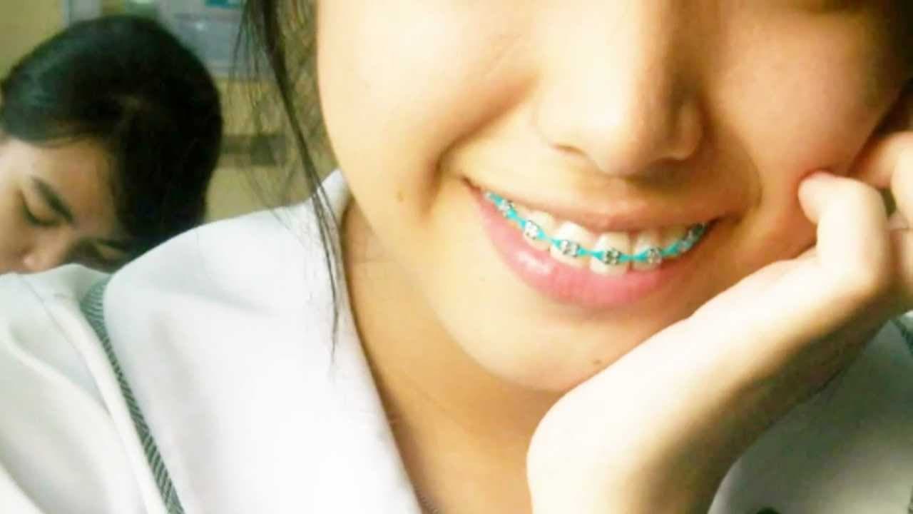 Buwelo - by Jireh Lim